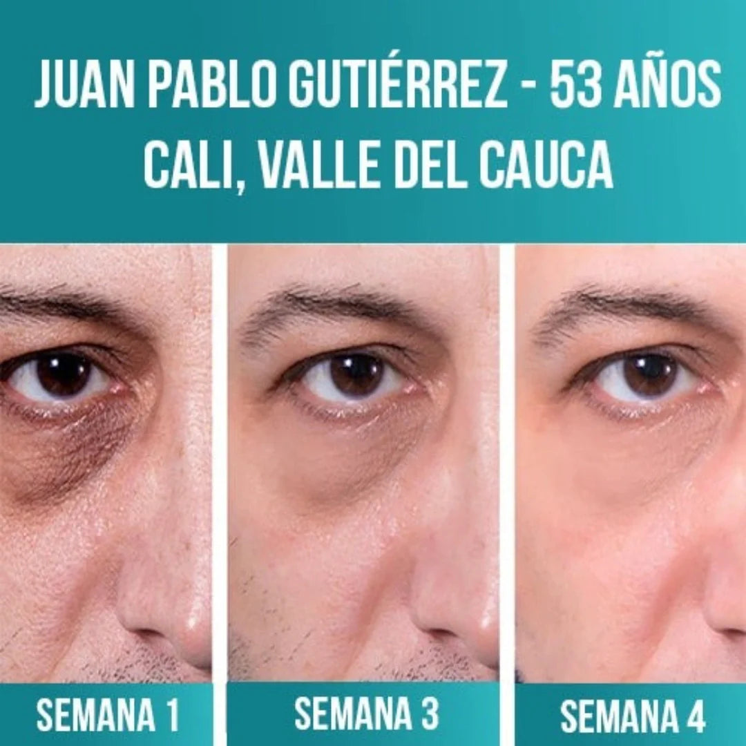 Elimina arrugas y reafirma tu piel con EELHOE Collagen® – Paga 1, recibe 2
